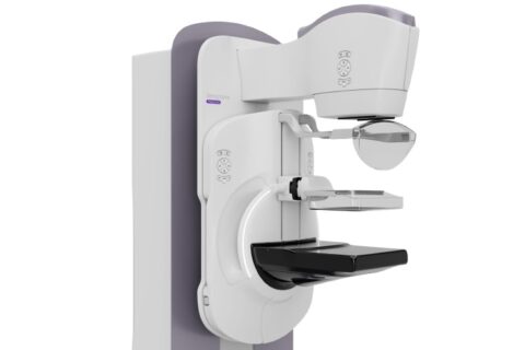 Ψηφιακός Μαστογράφος Τομοσύνθεσης Senographe Pristina 3D