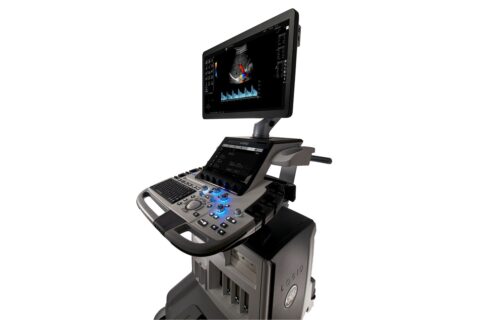 UGAP (Ultrasound-Guided Attenuation Parameter)